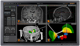 neuroinspire - planning screenshot (V4)